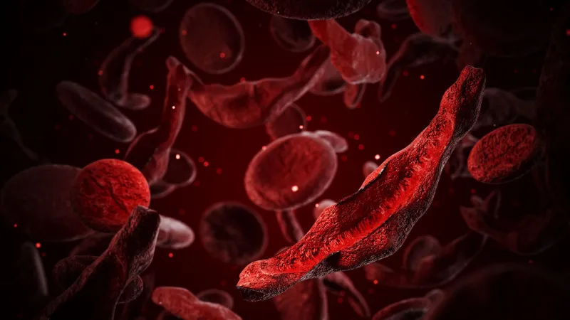 $3 million prize goes to duo whose research led to first sickle cell CRISPR therapy