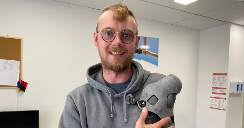 ‘I survived a tank hit. That’s bad ass’: British amputee chooses to stay in Ukraine after strike