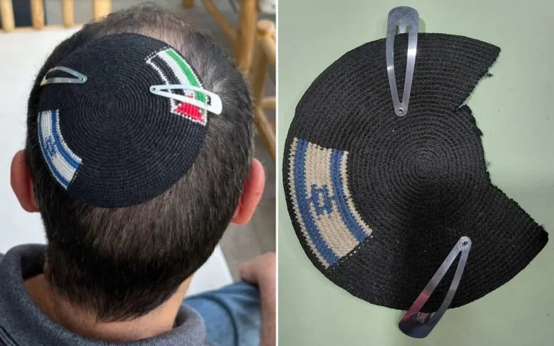 Police detain Modiin man for wearing kippa with Palestinian flag, cut it out
